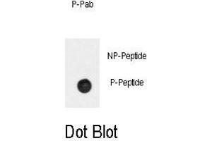 Image no. 1 for anti-Adrenergic, beta-2-, Receptor, Surface (ADRB2) (pSer261) antibody (ABIN358476)