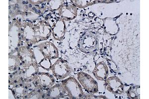Formalin-fixed and paraffin embedded rat kidney labeled with Anti-TPA/PLAT Polyclonal Antibody, Unconjugated (ABIN731123) followed by conjugation to the secondary antibody and DAB staining