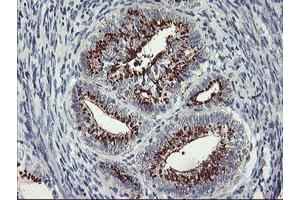 Image no. 4 for anti-Golgi Membrane Protein 1 (GOLM1) antibody (ABIN1498497) (GOLM1 抗体)