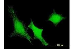 Immunofluorescence of monoclonal antibody to DUSP3 on HeLa cell. (Dual Specificity Phosphatase 3 (DUSP3) (AA 1-185) 抗体)