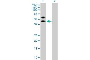 Western Blotting (WB) image for anti-serpin Peptidase Inhibitor, Clade A (Alpha-1 Antiproteinase, Antitrypsin), Member 3 (SERPINA3) (AA 1-423) antibody (ABIN513024)