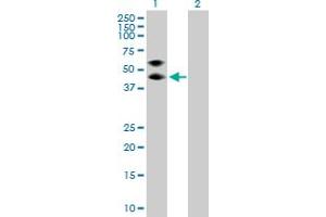 Western Blot analysis of SERPINA3 expression in transfected 293T cell line by SERPINA3 MaxPab polyclonal antibody. (SERPINA3 抗体  (AA 1-423))