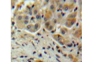 Used in DAB staining on fromalin fixed paraffin-embedded Liver tissue (SERPINA10 抗体  (AA 6-125))