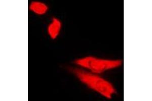 Immunofluorescent analysis of Topoisomerase 2 beta staining in Jurkat cells. (TOP2B 抗体  (N-Term))