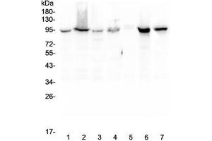 Western blot testing of human 1) HeLa, 2) COLO-320, 3) HepG2, 4) MCF7, 5) SW620, 6) 22RV1 and 7) Jurkat lysate with Beta Catenin antibody. (beta Catenin 抗体  (AA 2-233))