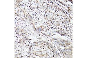 Immunohistochemistry (IHC) image for anti-Solute Carrier Family 16 (Monocarboxylic Acid Transporters), Member 3 (SLC16A3) (AA 371-465) antibody (ABIN6147859)