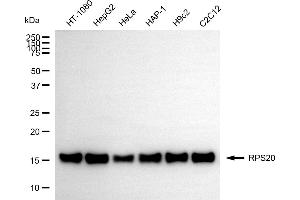 anti-Ribosomal Protein S20 (RPS20) antibody