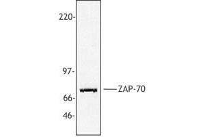 Image no. 1 for anti-zeta-Chain (TCR) Associated Protein Kinase 70kDa (ZAP70) (AA 282-307) antibody (ABIN205364) (ZAP70 抗体  (AA 282-307))