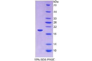 SDS-PAGE analysis of Human IGFBP2 Protein. (IGFBP2 蛋白)
