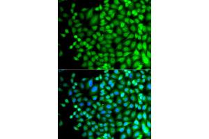 Immunofluorescence analysis of A549 cells using SUPT20H antibody. (FAM48A/P38IP 抗体)