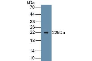 Detection of Recombinant AVIL, Mouse using Polyclonal Antibody to Advillin (AVIL) (Advillin 抗体  (AA 1-160))