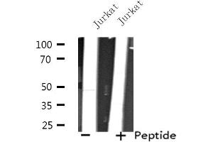 Western blot analysis of extracts from Jurkat cells, using TEAD3 antibody. (TEAD3 抗体  (Internal Region))