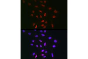 Immunofluorescence analysis of U-2 OS cells using TDP1 Rabbit pAb (ABIN1682992, ABIN3019238, ABIN3019239 and ABIN6220782) at dilution of 1:100 (40x lens). (TDP1 抗体  (AA 1-140))