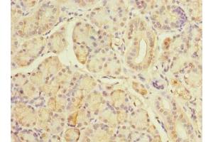 Immunohistochemistry of paraffin-embedded human pancreatic tissue using ABIN7171606 at dilution of 1:100 (TBC1D19 抗体  (AA 1-300))