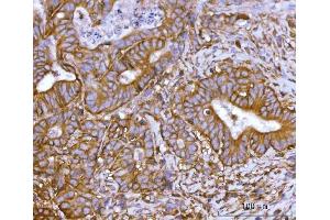 IHC analysis of SNAP23 using anti-SNAP23 antibody (ABIN7599089).
