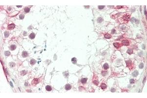 Formalin-fixed and paraffin-embedded H. (GP6 抗体  (C-Term))