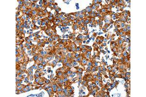 Immunohistochemistry (IHC) image for anti-Kallikrein 2 (KLK2) antibody (ABIN1873440) (Kallikrein 2 抗体)