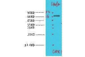 Western Blotting (WB) image for anti-Cytochrome C Oxidase Subunit I (COX1) antibody (ABIN3181265) (COX1 抗体)