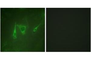Immunofluorescence analysis of NIH-3T3 cells, using 14-3-3 zeta/delta (Ab-232) Antibody. (14-3-3 zeta 抗体  (AA 196-245))
