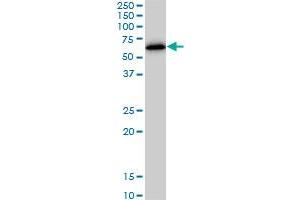 Western Blotting (WB) image for anti-Zinc Finger Protein 622 (ZNF622) (AA 1-100) antibody (ABIN566640)