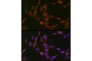 anti-Autophagy related 4B Cysteine Peptidase (ATG4B) antibody