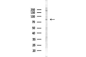 Western blot analysis of lysates from K562 cells(starvation 24h treatment), using FOXM1 Antibody at 1/1000 dilution.