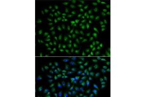 Immunofluorescence analysis of U2OS cells using RBPJ Polyclonal Antibody (RBPJ 抗体)