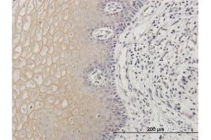 Immunoperoxidase of purified MaxPab antibody to TGM1 on formalin-fixed paraffin-embedded human uterine cervix. (TGM1 抗体  (AA 1-817))