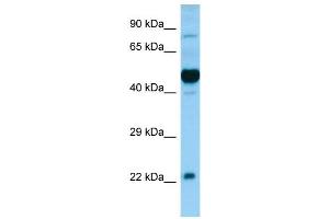 WB Suggested Anti-HCRTR1 Antibody Titration: 0.