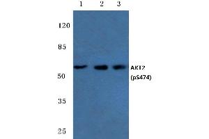 Western blot (WB) analysis of p-AKT2 antibody at 1/500 dilution (AKT2 抗体  (pSer474))