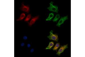 ABIN7094372 and ABIN7098419 staining HepG2 cells by IF/ICC. (CRYM 抗体  (Internal Region))