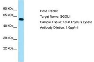 Image no. 1 for anti-Shugoshin 1 (SGOL1) (AA 395-444) antibody (ABIN6749951)