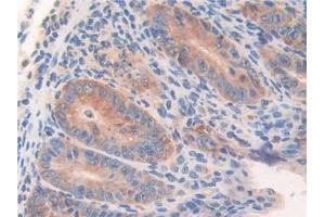 Immunohistochemistry (IHC) image for anti-Tryptophanyl-tRNA Synthetase (WARS) (AA 29-195) antibody (ABIN7442099)