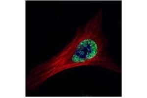 Immunofluorescence (IF) image for anti-V-Ets Erythroblastosis Virus E26 Oncogene Homolog 2 (ETS2) (Center) antibody (ABIN2855845)