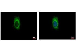 ICC/IF Image ZDHHC13 antibody [C3], C-term detects ZDHHC13 protein at cytoplasm by immunofluorescent analysis. (ZDHHC13 抗体  (C-Term))