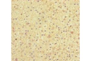 Immunohistochemistry (IHC) image for anti-Molybdenum Cofactor Synthesis 2 (MOCS2) (AA 1-188), (Catalytic Subunit) antibody (ABIN7160136)