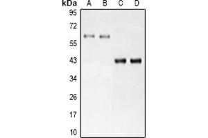 Western blot analysis of LRH-1 expression in MCF7 (A), Hela (B), mouse liver (C), rat liver (D) whole cell lysates. (NR5A2 + LRH1 抗体)