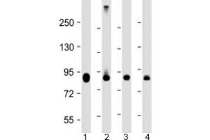 Western blot testing of human 1) HeLa, 2) Jurkat, 3) COS-7 and 4) mouse heart lysate with PFKP antibody at 1:4000. (PFKP 抗体  (AA 40-300))