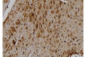 ABIN6259201 and ABIN6275855 at 1/100 staining Human heart tissue by IHC-P. (STK33 抗体  (N-Term))