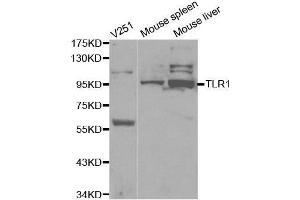 Western blot analysis of extracts of various cell lines, using TLR1 antibody. (TLR1 抗体  (AA 30-290))