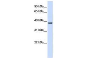 anti-Ras Association (RalGDS/AF-6) Domain Family (N-terminal) Member 7 (RASSF7) (AA 288-337) antibody