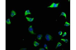 Immunofluorescence staining of A549 cells with ABIN7140223 at 1:50, counter-stained with DAPI. (CACNG6 抗体  (AA 22-39))
