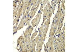 Immunohistochemistry of paraffin-embedded mouse heart using FXN antibody. (Frataxin 抗体)