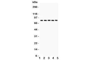 Western blot testing of Calpain antibody and Lane 1:  rat lung (Calpain 抗体  (Catalytic Subunit))