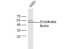 U251 lysates probed with Anti-Endothelial lipase Polyclonal Antibody, Unconjugated  at 1:5000 90min in 37˚C. (LIPG 抗体  (AA 301-400))