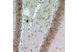 Immunohistochemical analysis of Bestrophin-2 staining in rat brain formalin fixed paraffin embedded tissue section. (Bestrophin 2 抗体)