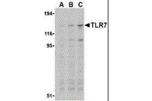 Western Blotting (WB) image for anti-Toll-Like Receptor 7 (TLR7) antibody (ABIN2476854) (TLR7 抗体)