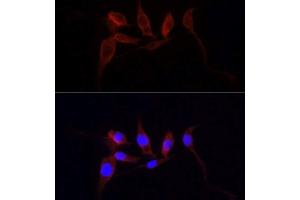 Immunofluorescence (IF) image for anti-Yes-Associated Protein 1 (YAP1) antibody (ABIN1683302)