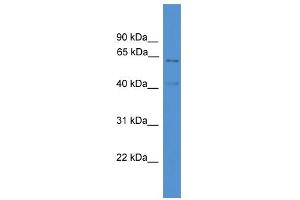 WB Suggested Anti-ACADVL Antibody Titration: 0. (ACADVL 抗体  (C-Term))