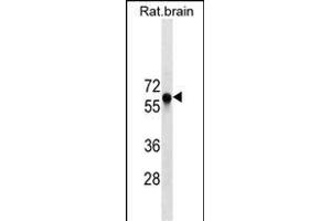 GAD2 Antibody ABIN1539900 western blot analysis in rat brain tissue lysates (35 μg/lane). (GAD65 抗体  (AA 109-138))
